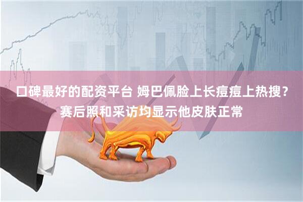口碑最好的配资平台 姆巴佩脸上长痘痘上热搜？赛后照和采访均显示他皮肤正常